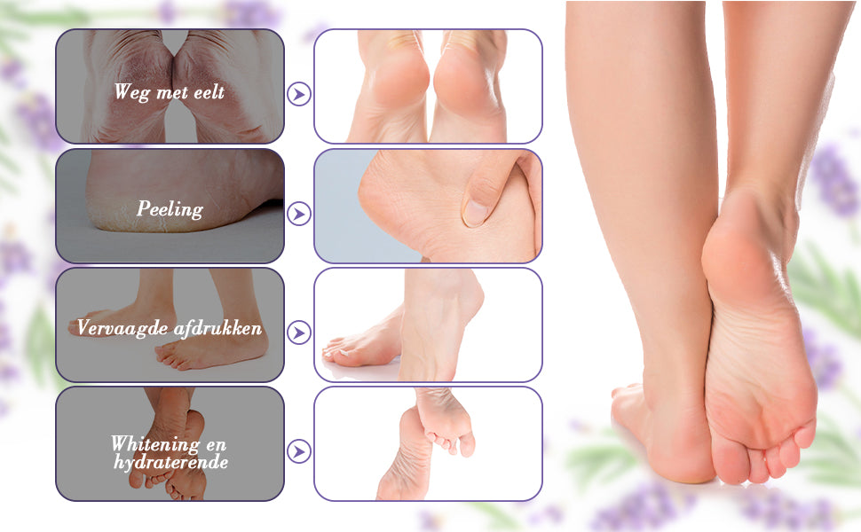 SoleSilk™ | Exfoliating Foot Mask