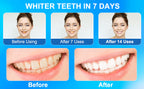 PearlEase™ | Effortless pearly whitening strips