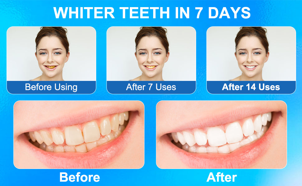 PearlEase™ | Effortless pearly whitening strips