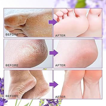 SoleSilk™ | Exfoliating Foot Mask
