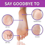 SoleSilk™ | Exfoliating Foot Mask