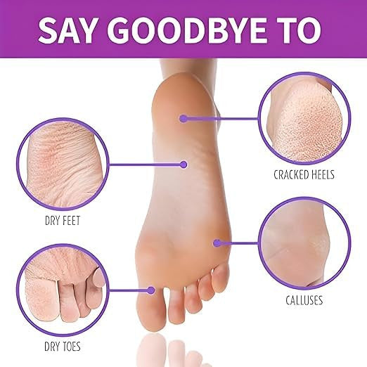SoleSilk™ | Exfoliating Foot Mask